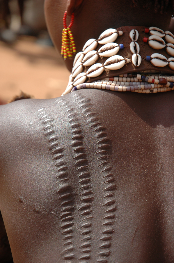 013   Etiopia